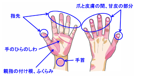 洗い残しやすい部分